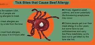 Image result for Apple Allergy Symptoms