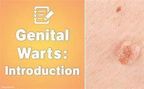 Image result for Mild Female Genital Warts