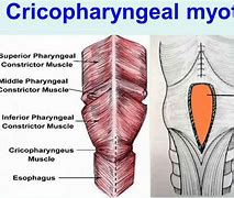 Image result for acatal�crico