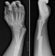 Image result for X-ray Vision