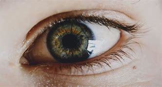 Image result for Corneal Refractive Surgery Astigmatism