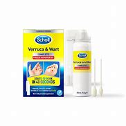 Image result for Wart Freeze Treatment