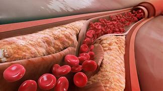 Image result for colesterol