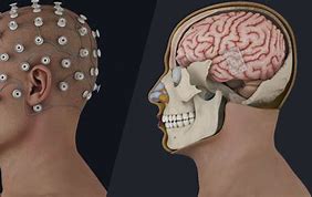 Image result for Brain Uncaged