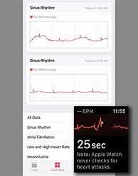Image result for Apple Watch Health Monitor Features