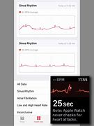 Image result for ECG Feature Apple Watch