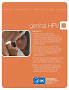 Image result for Causes of Genital Warts