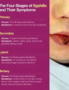 Image result for Syphilis Stages