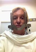 Image result for Gamma Knife Halo