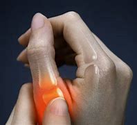 Image result for Broken Thumb Injury