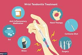 Image result for Wrist Tendonitis Treatment