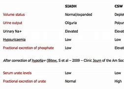 Image result for Diabetes Insipidus vs Siadh Chart