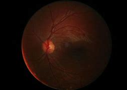 Image result for Anatomy of Retina Khurana Image