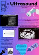 Image result for Anencephaly On Ultrasound