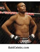 Image result for Bald UFC Fighters