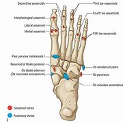 Image result for Accessory Bones Ankle