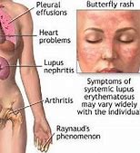 Image result for Differences Between Nephropathies