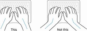 Image result for Keyboard Hand Strain