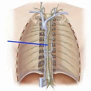 Image result for Thoracic Duct Cadaver