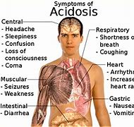 Image result for acidosix