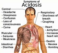 Image result for acidosis