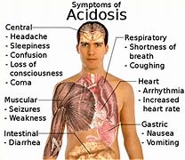 Image result for acidosid