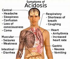 Image result for acidosus