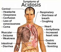 Image result for acisosis