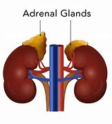 Image result for Nodule On Adrenal Gland