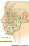 Image result for Lymph Nodes On Back of Tongue