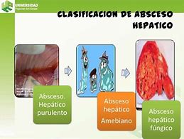 Image result for hep�tico