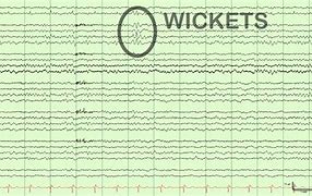 Image result for Wicket Waves