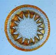 Image result for Moss Spore Capsule