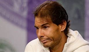 Image result for Rafael Nadal Balding