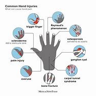 Image result for Thumb Pain Sign