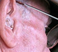 Image result for Newest Hearing Aids