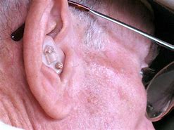 Image result for Behind Ear Hearing Aids