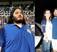 Image result for Anant Ambani Before and After