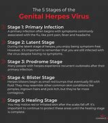Image result for Male Genital Herpes