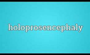 Image result for Holoprosencephaly