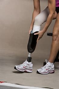 Image result for Amputee Leg Brace