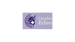 Image result for scecho