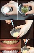 Image result for Home Teeth Whitening