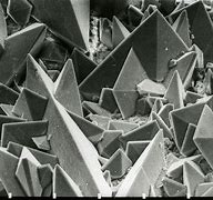 Image result for Kidney Stone Under a Microscope