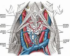 Image result for Carotid and Vertebral Arteries