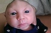 Image result for Baby Born without a Brain S