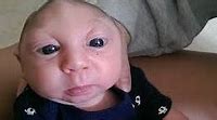 Image result for Babies with No Brain