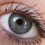 Image result for Reare Eye