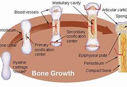 Image result for Wherre Can Bone Spur Grow Hip