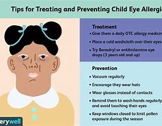 Image result for Eye Allergies in Children